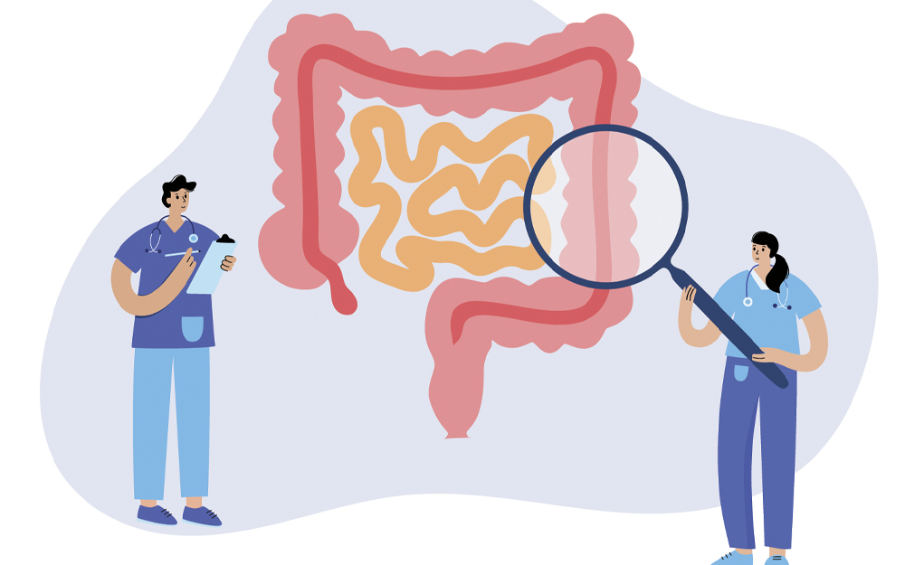 7 Langkah Deteksi Dini Kanker Usus Besar