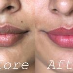 10 Cara Alami Mencerahkan Bibir Gelap