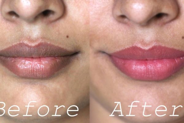 10 Cara Alami Mencerahkan Bibir Gelap