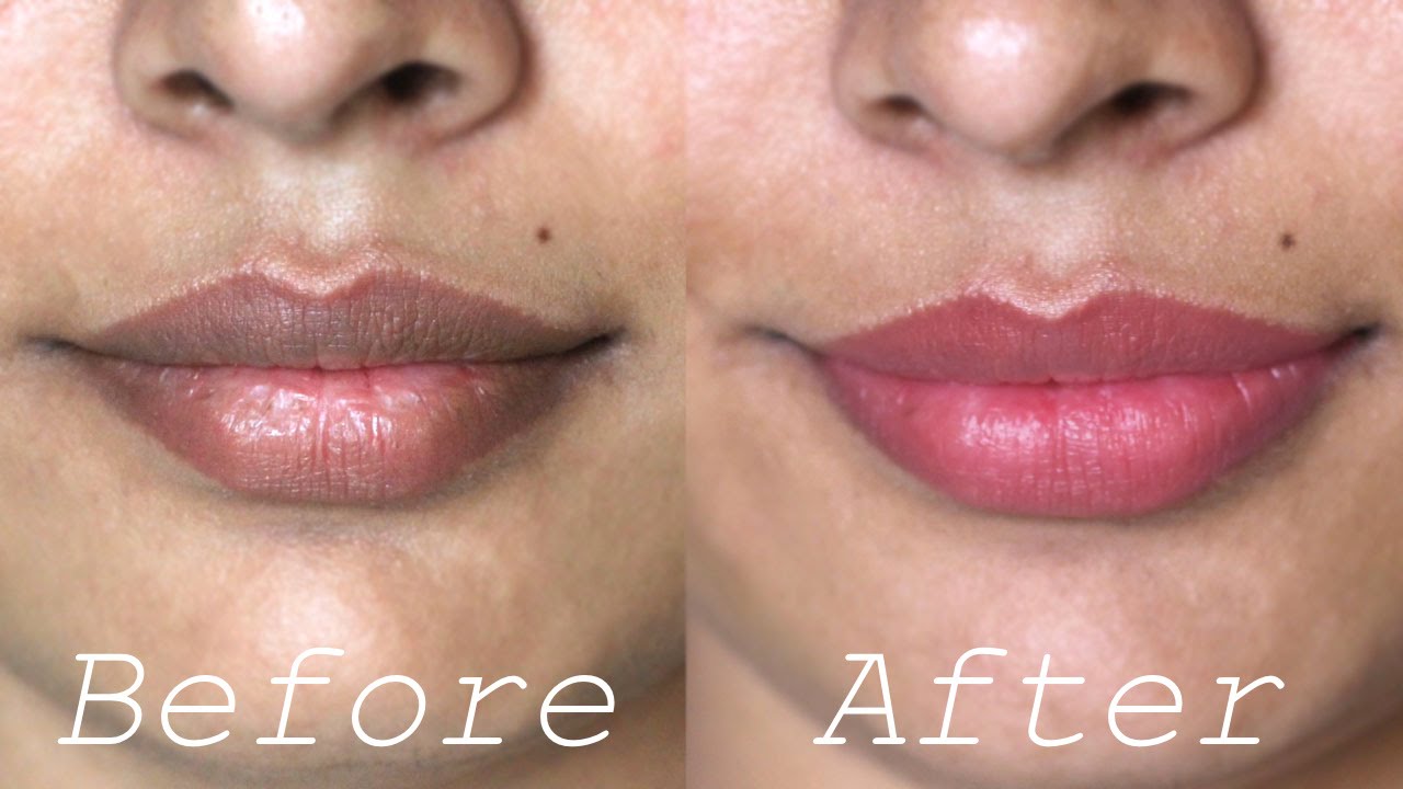 10 Cara Alami Mencerahkan Bibir Gelap